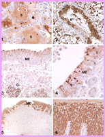 Infection types