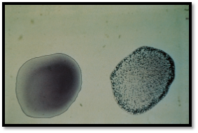 MG Serum Plate Agglutination test with negative (left) and positive (right)