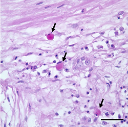 Histomoniasis PAS