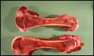 bone marrow normal