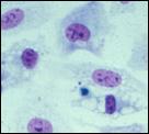 Bovine-viral-diarrhea-virus_CPE_2_fig19