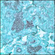GMS Pneumocystis Lung Mouse 6925-09 100Xb